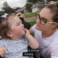 The Rare Life artwork
