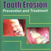 Dentistry Made Simple artwork