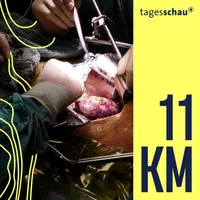11KM: der tagesschau-Podcast artwork