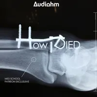 How i Died artwork